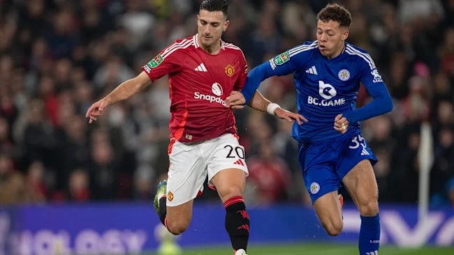 Nhận định bóng đá Manchester United vs Leicester City, 03h00 ngày 08/02 – FA Cup 